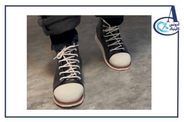 کفش طبی برای کوتاهی پا-ادونس کلینیک